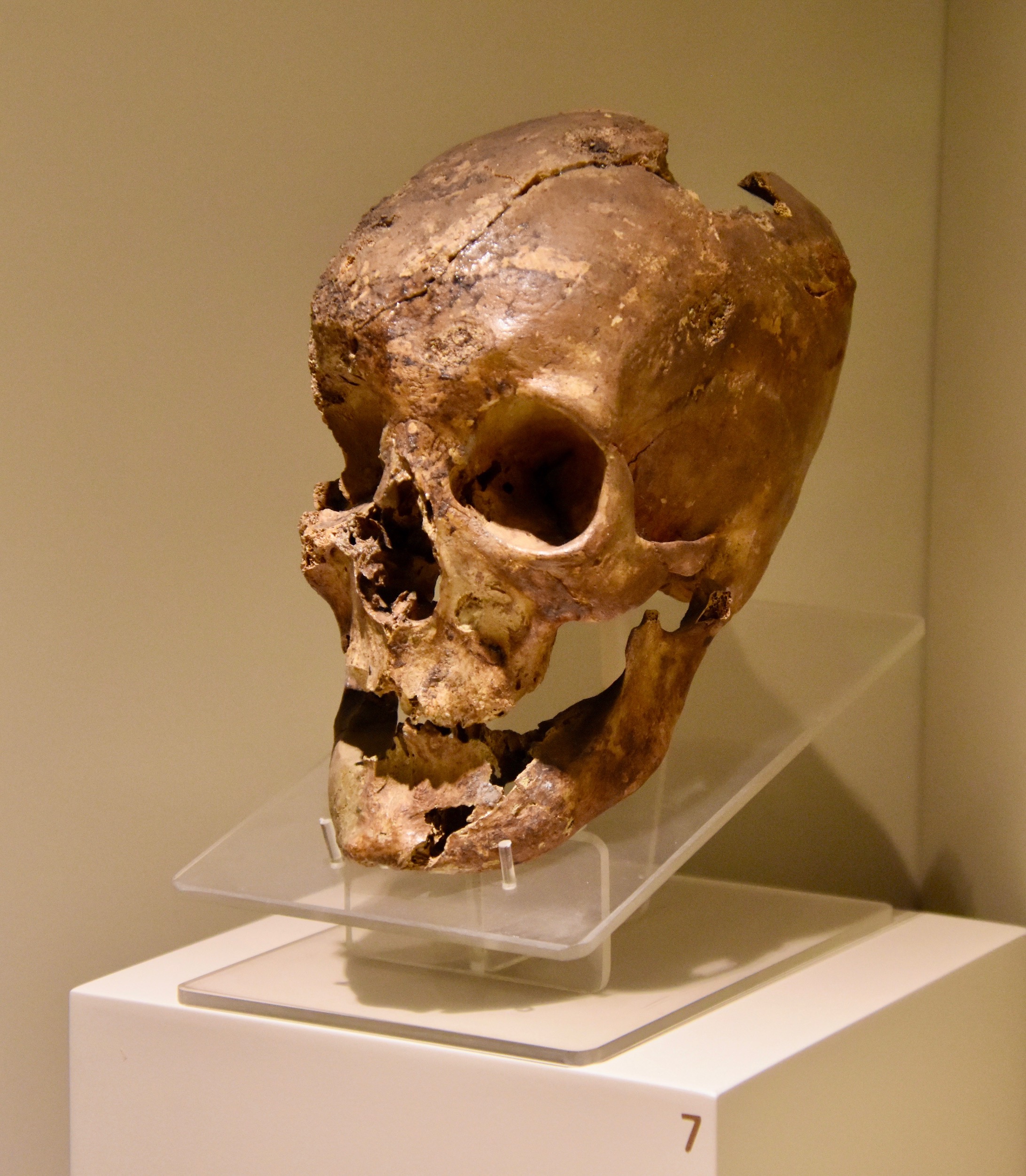 Skull of King Midas of Phrygia, Museum of Anatolian Civilizations